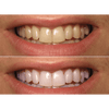 Image of Blanqueador Dental - D/White